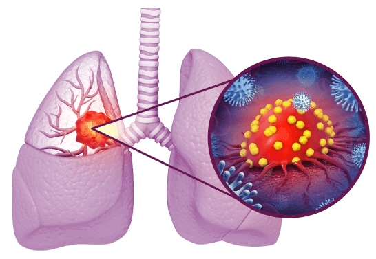 Рекомендации NCCN